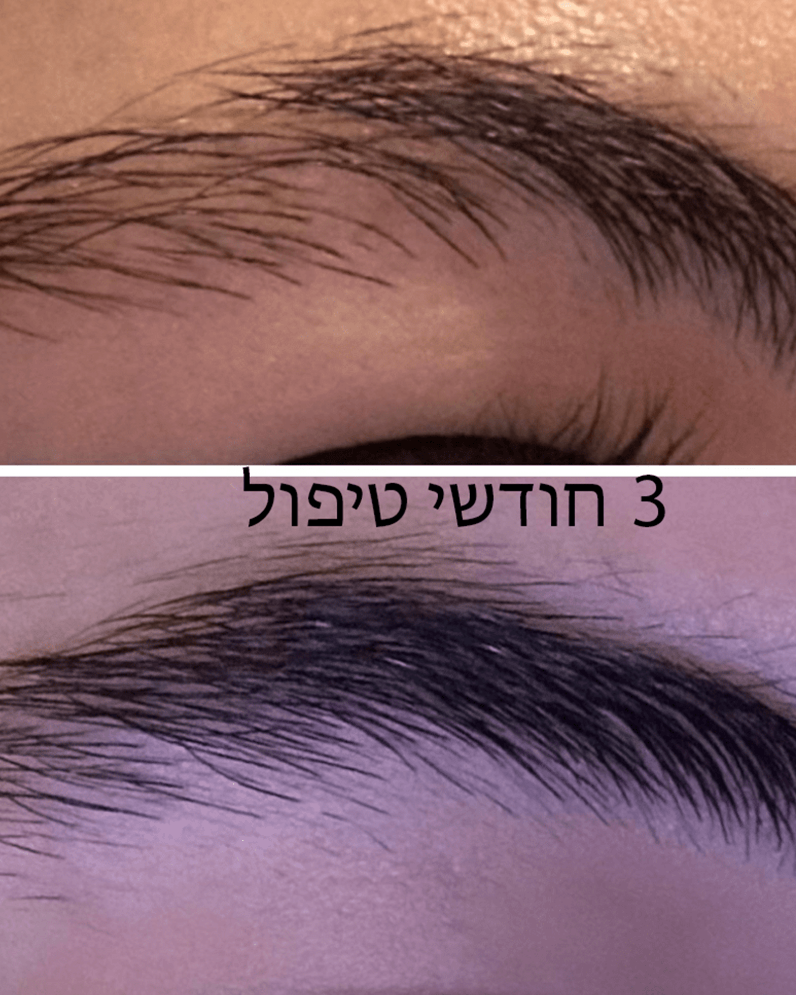 צמד מוצרים לשיקום וטיפוח הגבות - Be La Belle CosmeticsBe La Belle Cosmetics